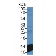 Western blot analysis of Human Platelet lysate, using Human bTG Antibody and HRP-conjugated Goat Anti-Mouse antibody (<a href="https://www.abbexa.com/index.php?route=product/search&amp;search=abx400001" target="_blank">abx400001</a>, 0.2 µg/ml).