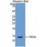 Western blot analysis of recombinant Pig IL8.