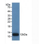 Western blot analysis of recombinant Human IL8.