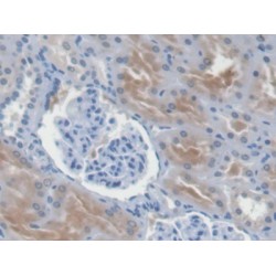 Interleukin 8 (IL8) Antibody
