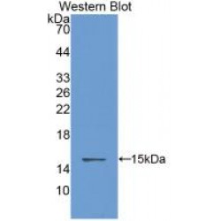 Cystatin B (CSTB) Antibody
