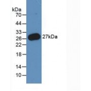 Western blot analysis of recombinant Human PMP22.