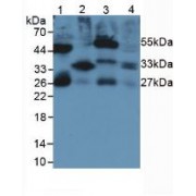 Western blot analysis of (1) Rat Serum, (2) Rat Lung Tissue, (3) Rat Intestine Tissue and (4) Rat Large Intestine Tissue.