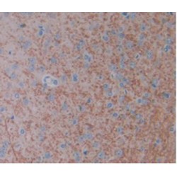 Fibroblast Growth Factor 1, Acidic / AFGF (FGF1) Antibody