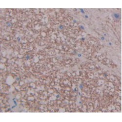 Fibroblast Growth Factor 1, Acidic / AFGF (FGF1) Antibody