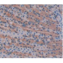 Fibroblast Growth Factor 1, Acidic / AFGF (FGF1) Antibody