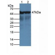 Western blot analysis of (1) Rat Serum Tissue, and (2) Rat Spleen Tissue, using Rabbit Anti-Human NSE Antibody (2 µg/ml) and HRP-conjugated Rabbit Anti-Mouse antibody (<a href="https://www.abbexa.com/index.php?route=product/search&amp;search=abx400002" target="_blank">abx400002</a>, 1:5000 dilution).