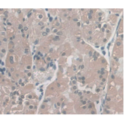 Gamma-Enolase (ENO2) Antibody