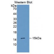 Western blot analysis of recombinant Human TGFa.