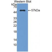 Western blot analysis of recombinant Rat FGb.