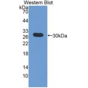 Western blot analysis of recombinant Human FGg.