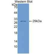 Western blot analysis of recombinant Human FKBP8.