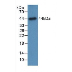 Galactosidase Alpha (GLa) Antibody