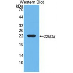 Vitamin D Binding Protein (Gc) Antibody
