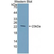 Western blot analysis of recombinant Rat GKRP.