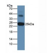 Western blot analysis of Human Liver Tissue, using Rabbit Anti-Human GSTa3 Antibody (2 µg/ml) and HRP-conjugated Rabbit Anti-Mouse antibody (<a href="https://www.abbexa.com/index.php?route=product/search&amp;search=abx400002" target="_blank">abx400002</a>, 1:5000 dilution).