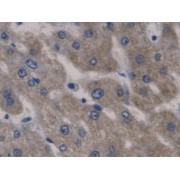 IHC-P analysis of Human Liver Tissue, with DAB staining.