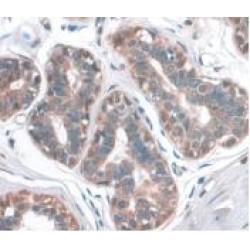 Hematopoietic Progenitor Cell Antigen CD34 (CD34) Antibody