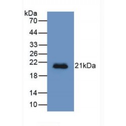 Hemojuvelin (HJV) Antibody