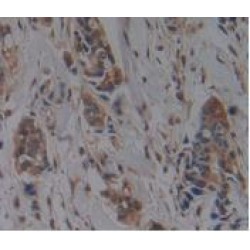Hemojuvelin (HJV) Antibody