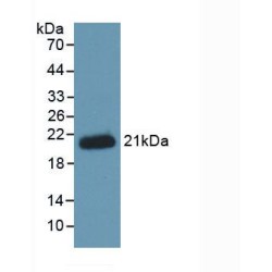 Hemojuvelin (HJV) Antibody