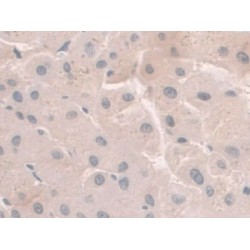 Hemojuvelin (HJV) Antibody