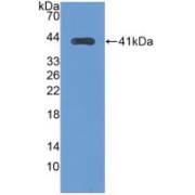 Western blot analysis of recombinant Human TFR2.