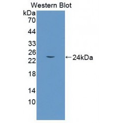 Heme Oxygenase 1, Decycling (HO1) Antibody