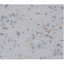 Heat Shock Protein Beta-1 (HSPB1) Antibody