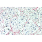 IHC-P analysis of Human Adrenal Tissue, with Vector Red Staining, using Cortisol Antibody (10 µg/ml).