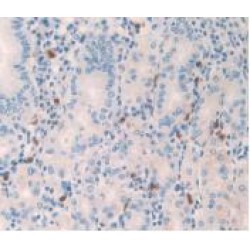 Islet Amyloid Polypeptide (IAPP) Antibody