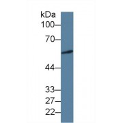 Western blot analysis of Human A549 cell lysate, using Human ICA1 Antibody (3 µg/ml) and HRP-conjugated Goat Anti-Mouse antibody (<a href="https://www.abbexa.com/index.php?route=product/search&amp;search=abx400001" target="_blank">abx400001</a>, 0.2 µg/ml).