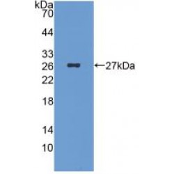 Islet Cell Autoantigen 1 (ICA1) Antibody