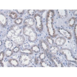Islet Cell Autoantigen 1 (ICA1) Antibody