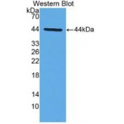 Western blot analysis of recombinant Pig IFNa (with N-terminal His and GST tags).