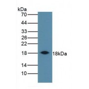 Western blot analysis of Cow Spleen Tissue, using Rabbit Anti-Sheep IFNg Antibody (3 µg/ml) and HRP-conjugated Rabbit Anti-Mouse antibody (<a href="https://www.abbexa.com/index.php?route=product/search&amp;search=abx400002" target="_blank">abx400002</a>, 1:5000 dilution).