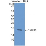 Western blot analysis of recombinant Rat IFNg.