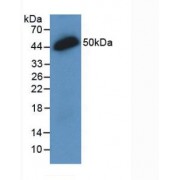 Western blot analysis of recombinant Human IL28A.