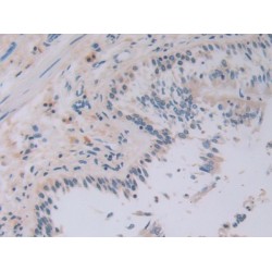 Interleukin 28A (IL28A) Antibody