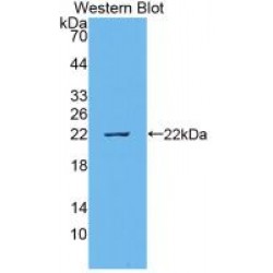 Interleukin 18 (IL18) Antibody