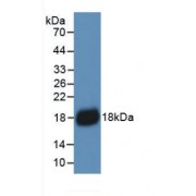 Western blot analysis of recombinant Human IL18.