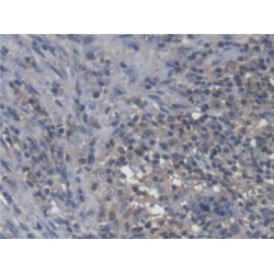 Interleukin 18 (IL18) Antibody