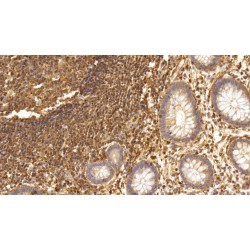 Interleukin 17A (IL17A) Antibody