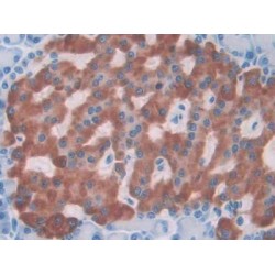 Interleukin 1 Alpha (IL1a) Antibody