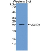 Western blot analysis of the recombinant protein.