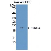 Western blot analysis of recombinant Rat IL1b Protein.