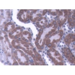 Interleukin 1 Beta (IL1b) Antibody