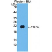 Western blot analysis of recombinant Human IL1b.