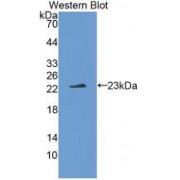 Western blot analysis of recombinant Human IL1z.