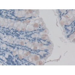 Interleukin 36 Gamma / IL1F9 (IL36G) Antibody